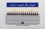 انواع رنگ لمینت دندان.jpg
