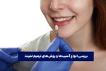 بررسی انواع آسیب‌ها و روش‌های ترمیم لمینت.jpg