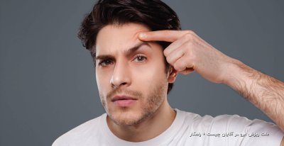 علت ریزش ابرو در آقایان چیست + راهکار